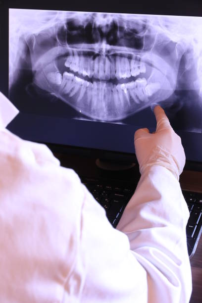 Best Emergency Tooth Extraction in Flemington, GA