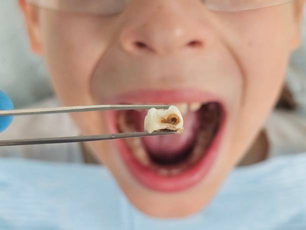 Best Pediatric Emergency Dentist in Flemington, GA